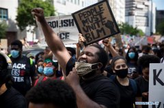 Human rights record of U.S. is appalling