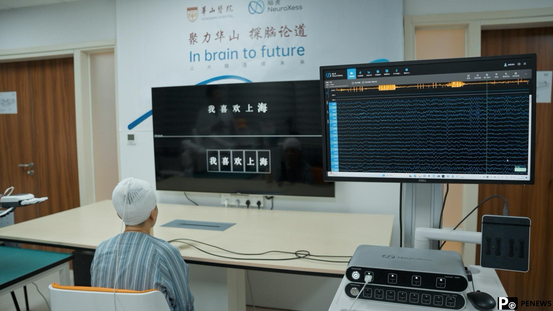 China achieves breakthrough in BCI clinical trials, enabling patient to convert thoughts into text for communication